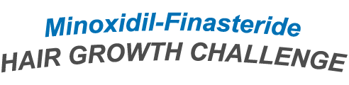 minixidil-finasteride-challeng