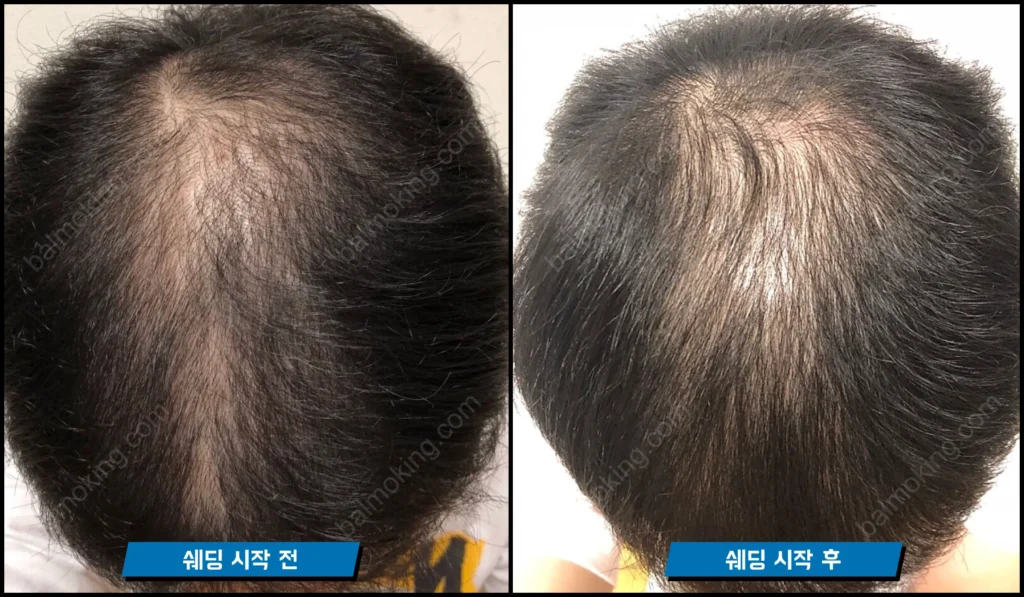 쉐딩 현상